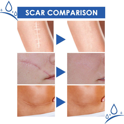 🏆50% OFF💥Say Goodbye to Scars in 4 Weeks — Clinically Proven Medical-Grade Formula