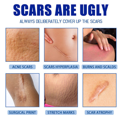 🏆50% OFF💥Say Goodbye to Scars in 4 Weeks — Clinically Proven Medical-Grade Formula
